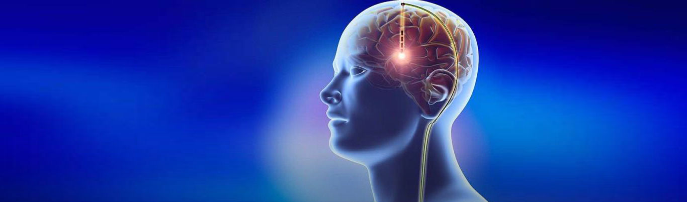 Neuro-Modulation